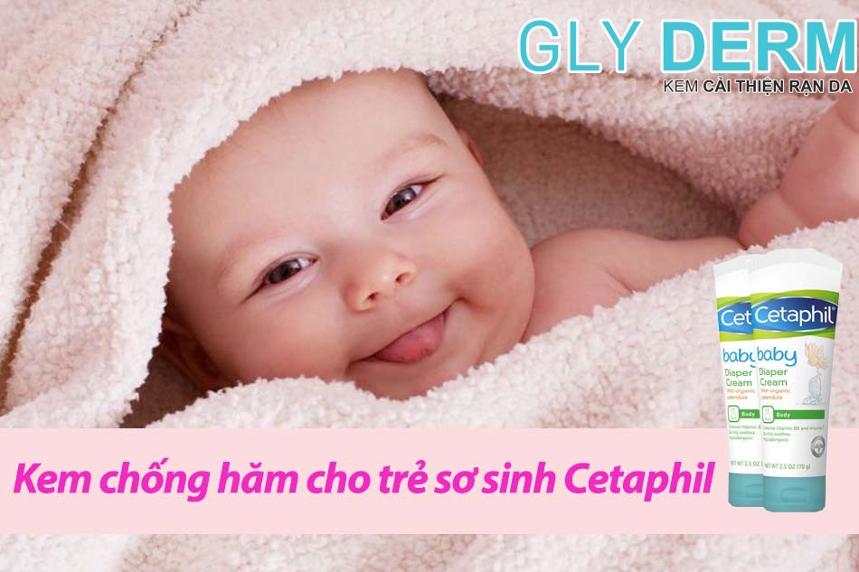 Kem chống hăm cho trẻ sơ sinh Cetaphil