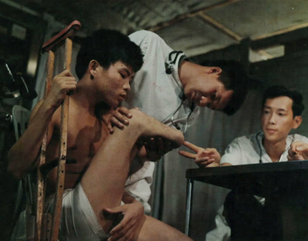 Khám bệnh nhân cụt chân ở trong nhà tù Phú Quốc