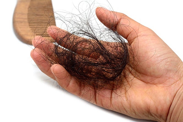 Có nhiều nguyên nhân gây hiện tượng rụng tóc