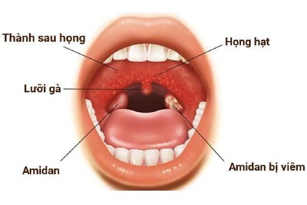 Sử dụng dây sắn đốt lấy tro để chữa bệnh có liên quan đến họng