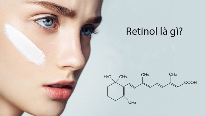 Retinol hỗ trợ điều trị mụn.