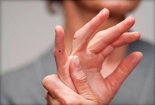 nốt ruồi ở ngón tay trỏ 